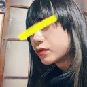 下まぶたたるみ取り / ヒアルロン酸注入（あご） / ボトックス（エラ・小顔） コスメディカルクリニック シンシア 銀座院 DAY 21 サムネイル用