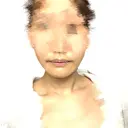 骨切り（あご） / 脂肪吸引（顔） 銀座マイアミ美容外科 DAY 118 サムネイル用