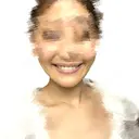 骨切り（あご） / 脂肪吸引（顔） 銀座マイアミ美容外科 DAY 118 サムネイル用