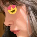 隆鼻術 / 鼻尖形成（切開） / 小鼻縮小（切開） / 軟骨移植 / 毛穴洗浄（ハイドラフェイシャルなど） グローバルビューティークリニック 大阪院 DAY 86 サムネイル用