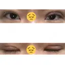眼瞼下垂（切開） ピュア形成外科医院 DAY 17 サムネイル用