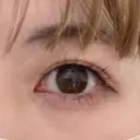 二重埋没 湘南美容クリニック 藤沢院 AFTER サムネイル用