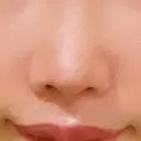 鼻翼基部形成（貴族手術） ジョウクリニック 大阪院 AFTER サムネイル用