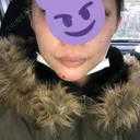 あごプロテーゼ 湘南美容クリニック 池袋西口院 DAY 9 サムネイル用