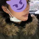 あごプロテーゼ 湘南美容クリニック 池袋西口院 DAY 9 サムネイル用
