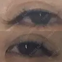 二重埋没 Olino美容外科・美容皮膚科 DAY 68 サムネイル用