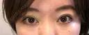 二重埋没 / 上まぶたの脂肪取り アリエル美容クリニック 郡山院 DAY 4 サムネイル用
