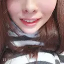 ガミースマイル手術 オーラルビューティークリニック白金 DAY 11 サムネイル用
