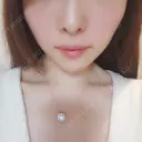 ガミースマイル手術 オーラルビューティークリニック白金 DAY 16 サムネイル用
