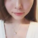 ガミースマイル手術 オーラルビューティークリニック白金 DAY 16 サムネイル用