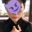 あごプロテーゼ 湘南美容クリニック 池袋西口院 DAY 10 サムネイル用