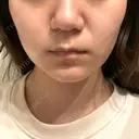 ポテンツァ レナータクリニック 立川院 DAY 1 サムネイル用