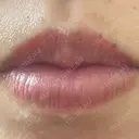 アートメイク（唇） こいずみ形成クリニック名古屋 AFTER サムネイル用