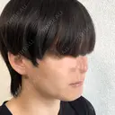 脂肪吸引（顔） 石倉クリニック 水戸院 DAY 14 サムネイル用
