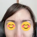 アートメイク（眉） TRUE DESIGN CLINIC DAY 3 サムネイル用