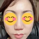 アートメイク（眉） TRUE DESIGN CLINIC DAY 4 サムネイル用