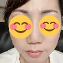 アートメイク（眉） TRUE DESIGN CLINIC DAY 5 サムネイル用