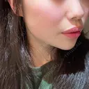 ヒアルロン酸注入（あご） ASTRA BEAUTY CLINIC DAY 0 サムネイル用