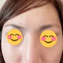 アートメイク（眉） TRUE DESIGN CLINIC AFTER サムネイル用