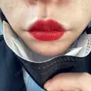 ヒアルロン酸注入（唇） / ボトックス（口角） ルラ美容クリニック 高田馬場院 AFTER サムネイル用