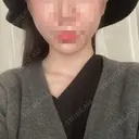 糸リフト / ルメッカ ブルームクリニック（BLOOM CLINIC） DAY 0 サムネイル用