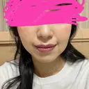 ボトックス（エラ・小顔） あいちビューティークリニック DAY 4 サムネイル用