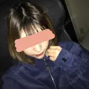 あごプロテーゼ 恵聖会クリニック 京橋院 DAY 39 サムネイル用