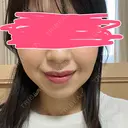 ボトックス（エラ・小顔） あいちビューティークリニック DAY 8 サムネイル用