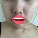 毛穴洗浄（ハイドラフェイシャルなど） / ピーリング（ハリ・ツヤ） / ミラノリピール Casa de GRACIA GINZA 【カーサデグラシアギンザ】 DAY 7 サムネイル用