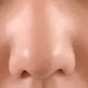 小鼻縮小（切開） GLANZ CLINIC AFTER サムネイル用