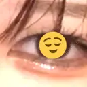 ヒアルロン酸注入（涙袋） / ボトックス（タレ目） アネシス美容クリニック AFTER サムネイル用