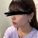 肌ヒアルロン酸注入（たるみ・シワ改善） / ヒアルロン酸注入（あご） / ボトックス（エラ・小顔） LE CLINIC DAY 1 サムネイル用