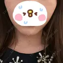 脂肪溶解注射（顔） LIGHT CLINIC 【ライトクリニック】 名古屋院 DAY 3 サムネイル用