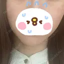 脂肪溶解注射（顔） LIGHT CLINIC 【ライトクリニック】 名古屋院 DAY 5 サムネイル用