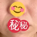 PRP皮膚再生療法 聖心美容クリニック 六本木院 DAY 20 サムネイル用