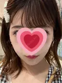 インディバ（顔） WOM SALON【術後ケア取扱いサロン】 AFTER サムネイル用