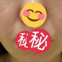 PRP皮膚再生療法 聖心美容クリニック 六本木院 DAY 91 サムネイル用