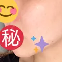 PRP皮膚再生療法 聖心美容クリニック 六本木院 DAY 96 サムネイル用