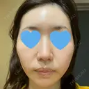 ポテンツァ LOUIS CLINIC 二子玉川院【ルイクリニック】 DAY 2 サムネイル用