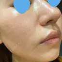 ポテンツァ LOUIS CLINIC 二子玉川院【ルイクリニック】 DAY 2 サムネイル用