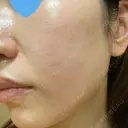 ポテンツァ LOUIS CLINIC 二子玉川院【ルイクリニック】 DAY 2 サムネイル用