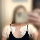 ワキ汗治療（切開） / ヒアルロン酸注入（涙袋） / ヒアルロン酸注入（額） 石倉クリニック 水戸院 AFTER サムネイル用