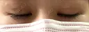 二重埋没 Olino美容外科・美容皮膚科 DAY 15 サムネイル用