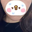 脂肪溶解注射（顔） LIGHT CLINIC 【ライトクリニック】 名古屋院 DAY 13 サムネイル用