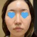 ポテンツァ LOUIS CLINIC 二子玉川院【ルイクリニック】 DAY 6 サムネイル用
