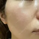 ポテンツァ LOUIS CLINIC 二子玉川院【ルイクリニック】 DAY 6 サムネイル用