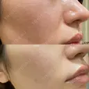 ポテンツァ LOUIS CLINIC 二子玉川院【ルイクリニック】 DAY 7 サムネイル用