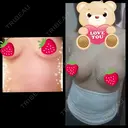 豊胸（シリコンバッグ） 湘南美容クリニック 名古屋栄院 DAY 3 サムネイル用