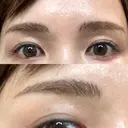 アートメイク（眉） ハナビューティークリニック DAY 6 サムネイル用