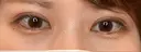 二重埋没 Olino美容外科・美容皮膚科 DAY 28 サムネイル用